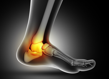 Ayak Bileği Artroskopisi